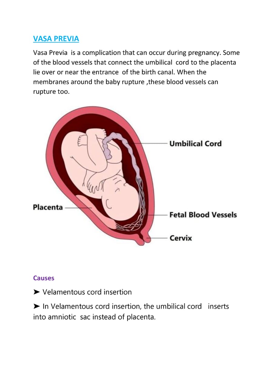 CAUSES OF BLEEDING IN PREGNANCY – Stepped-up Nurse Academy